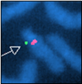 Imprinting centre and SNRPN probes from 15q11.2